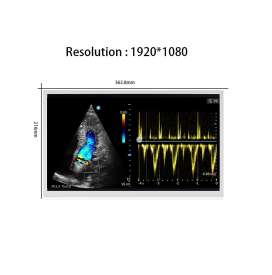Tianma P1560FHF1MB00 15.6-inch FHD IPS Industrial LCD | LVDS Interface, 400 nits, Wide Temperature