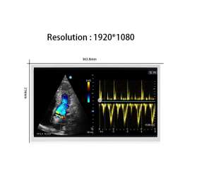 Tianma P1560FHF1MB00 15.6-inch FHD IPS Industrial LCD | LVDS Interface, 400 nits, Wide Temperature