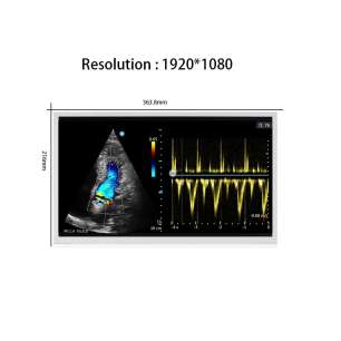 Tianma P1560FHF1MB00 15.6-inch FHD...