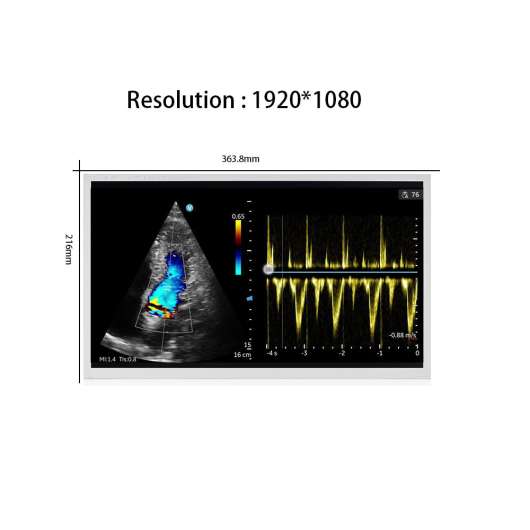 Tianma-P1560FHF1MB00-15.6-inch-FHD-Industrial-LCD-Module